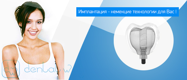 имплантация зубов имплантация зубов в Подольске